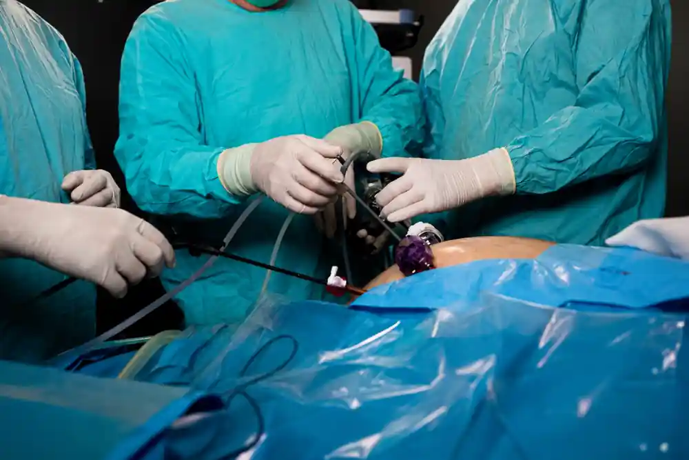Laser Fistula Treatment