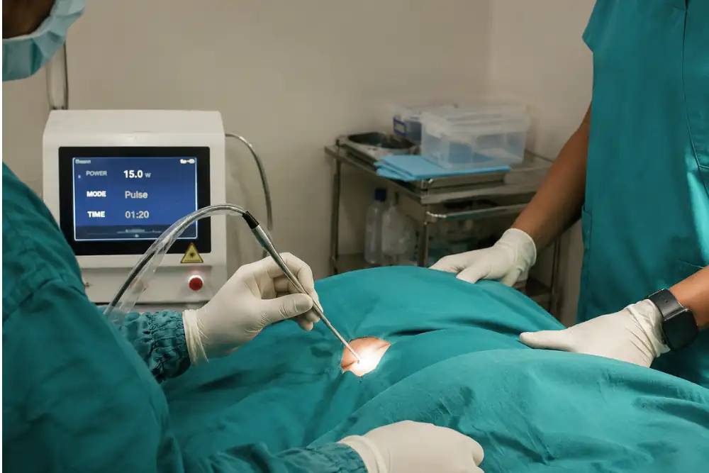 Laser_Anal_Fissure_Treatment_25kb